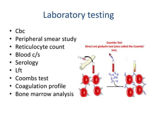 Laboratory testing
• Cbc
• Peripheral smear study
• Reticulocyte count
• Blood c/s
• Serology
• Lft
• Coombs test
• Coagulation profile
• Bone marrow analysis
 
