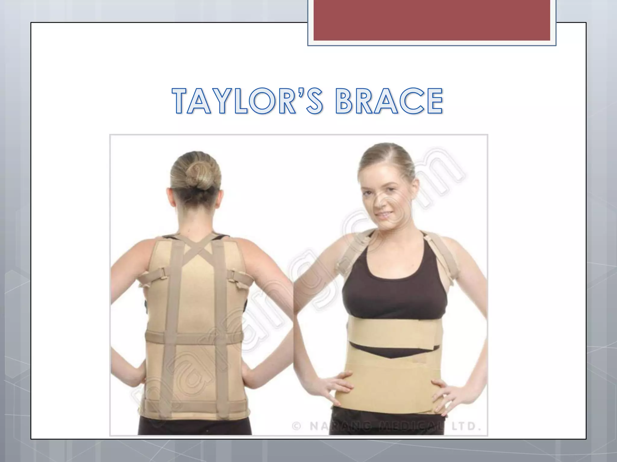 Splint and tractions | PPTX