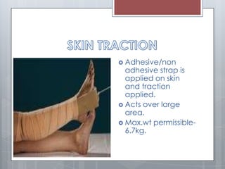  Adhesive/non
adhesive strap is
applied on skin
and traction
applied.
 Acts over large
area.
 Max.wt permissible-
6.7kg.
 