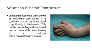 Comprehensive Guide to Splints, Traction, and Mobility Aids in ...