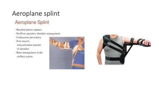 Comprehensive Guide to Splints, Traction, and Mobility Aids in ...