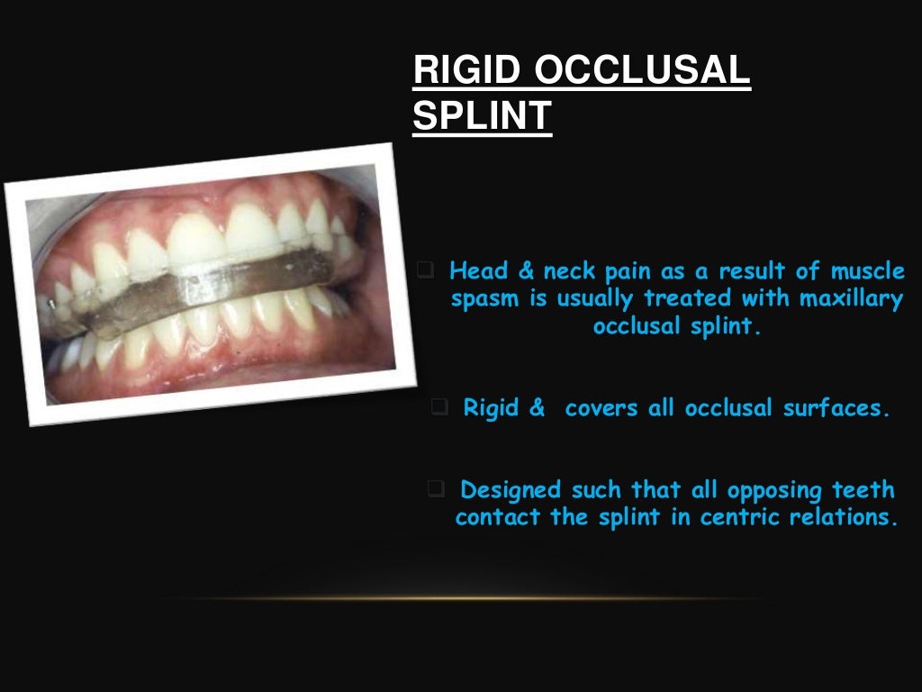 Splinting of teeth in periodontics