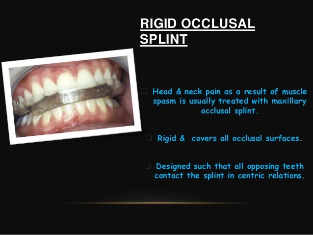 Splinting of teeth in periodontics