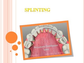 Splintimng Splinting | PPTX