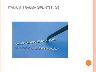 Tsf Splint Splinting | PPTX