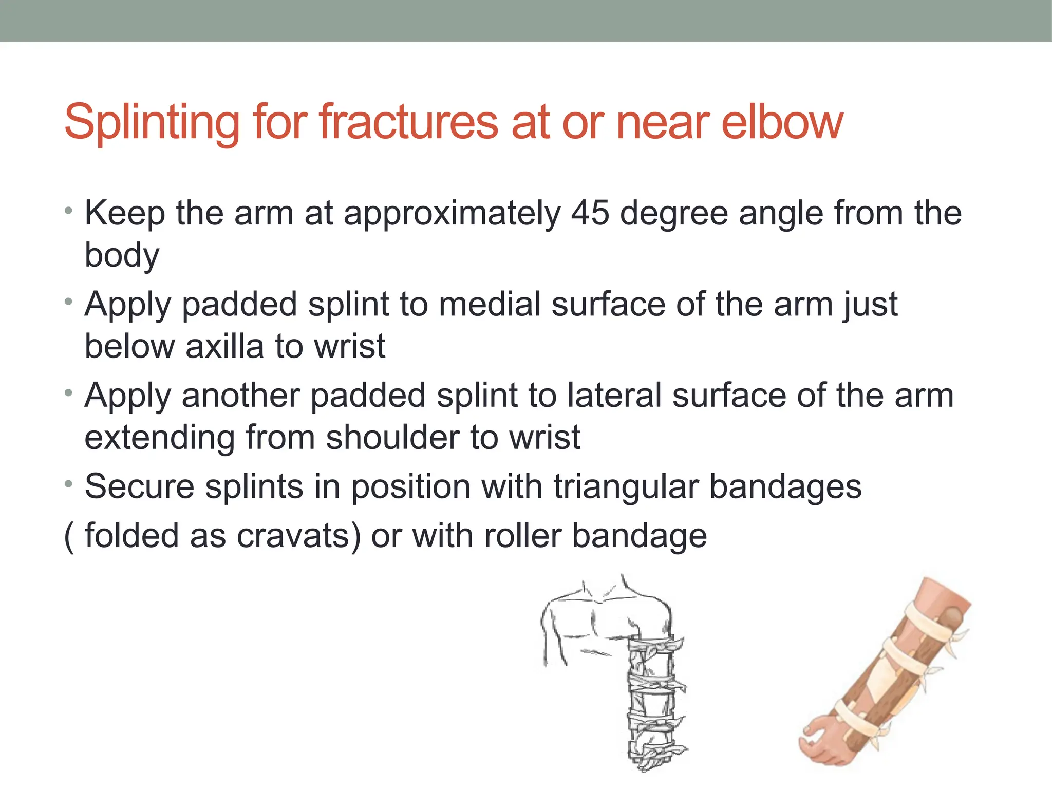 The technique for the proper application of splint. of | PPTX