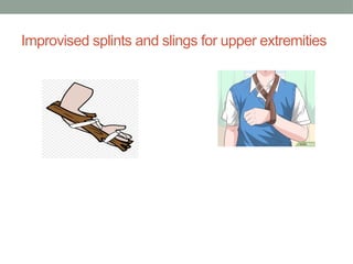 Unconventuonal Splints The technique for the proper application of splint. of | PPTX