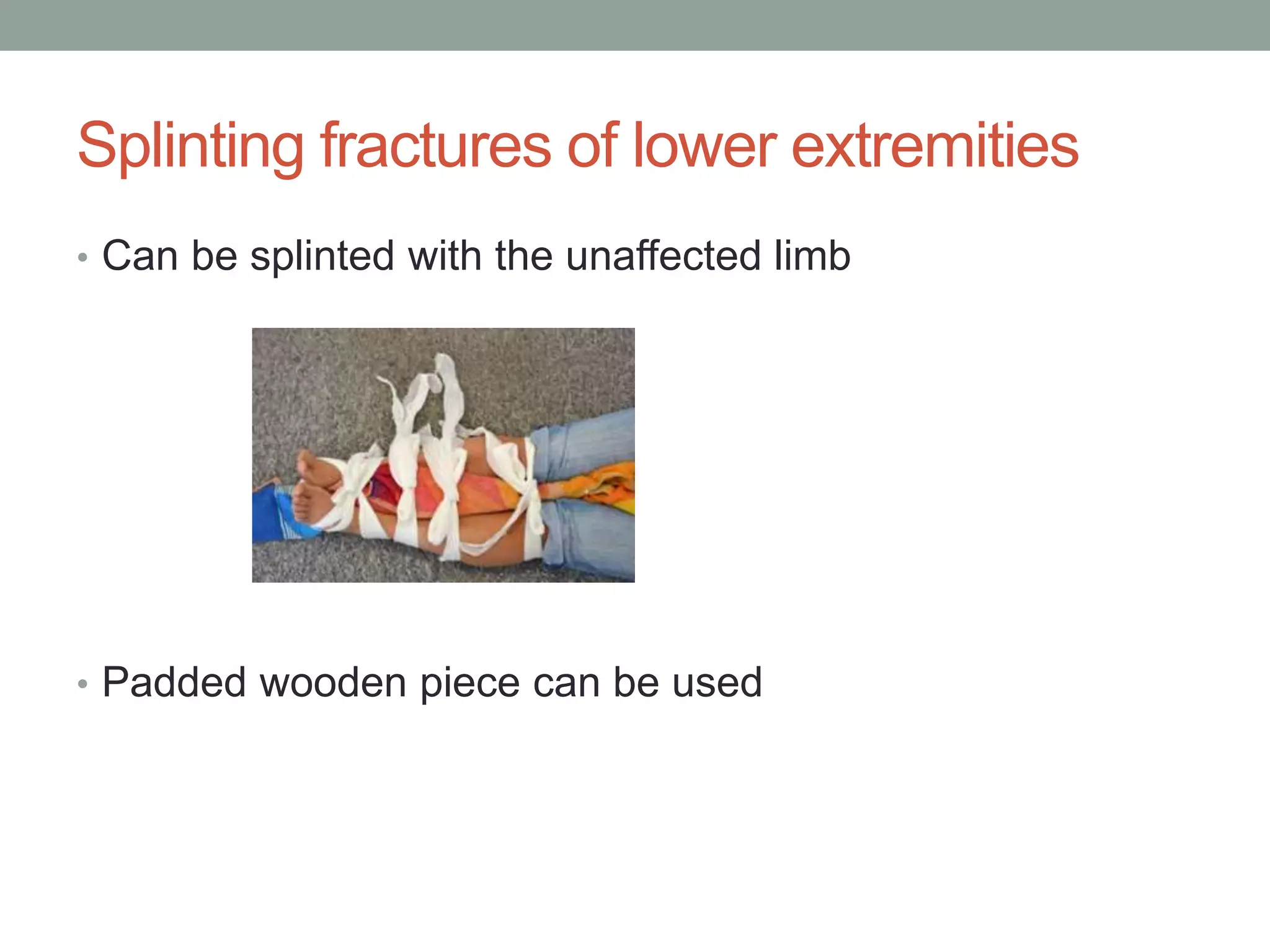 Splinting in first aid | PPTX