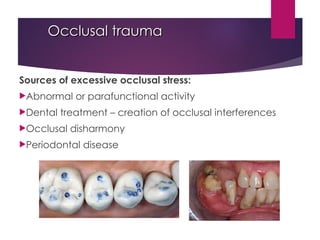 Occlusal trauma
Occlusal trauma
Sources of excessive occlusal stress:
Abnormal or parafunctional activity
Dental treatment – creation of occlusal interferences
Occlusal disharmony
Periodontal disease
 