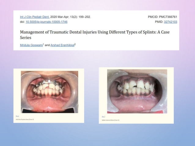 SPLINTING-MATERIALS AND TECHNIQUES final.pptx
