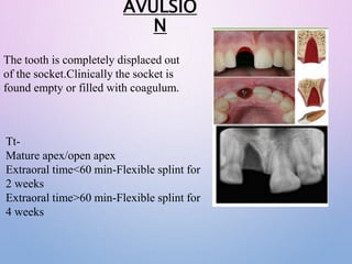 SPLINTING-MATERIALS AND TECHNIQUES final.pptx