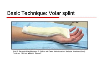 Splinting-Techniques in Orthopedics at Ease | PPT