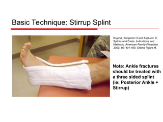 Splinting-Techniques for Orthopaedic Residency | PPT