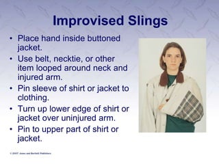 Improvised Slings
• Place hand inside buttoned
jacket.
• Use belt, necktie, or other
item looped around neck and
injured arm.
• Pin sleeve of shirt or jacket to
clothing.
• Turn up lower edge of shirt or
jacket over uninjured arm.
• Pin to upper part of shirt or
jacket.
 