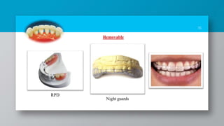 16
Removable
RPD
Night guards
 