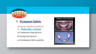 25
It may be classified as follows:
A. Removable—external
a) Continuous clasp devices
b) Swing-lock devices
c) Overdenture (full or partial)
3. Permanent Splints
 