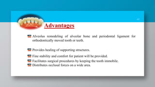 41
Advantages
Alveolus remodeling of alveolar bone and periodontal ligament for
orthodontically moved tooth or teeth.
Provides healing of supporting structures.
Fine stability and comfort for patient will be provided.
Facilitates surgical procedures by keeping the tooth immobile.
Distributes occlusal forces on a wide area.
 