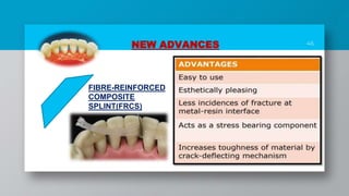 46
NEW ADVANCES
FIBRE-REINFORCED
COMPOSITE
SPLINT(FRCS)
 