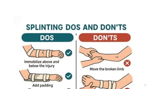 Splinting Def Splinting in orthopaedics.pptx gchgmgcgccgcg | PPTX