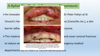 A Splint For Medical Emergency Department.
An innovative approach in splinting developed by Dr Peter Foltyn at St
Vincent’s Hospital, Sydney, is the use of Stomahesive (ConvaTec Inc.), a skin
barrier adhesive material used for superﬁcial skin trauma.
This material can crudely hold teeth in the socket and cover coronal fractures
to reduce sensitivity when patients are seen in emergency medical
departments out of hours of routine dental practice.
 
