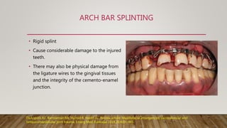 Splinting of traumatized teeth | PPTX