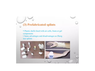 Splinting Methods SPLINTING TECHNIQUES.pptx orthopaedics ppt | PPTX