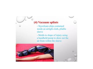 Splinting Methods SPLINTING TECHNIQUES.pptx orthopaedics ppt | PPTX