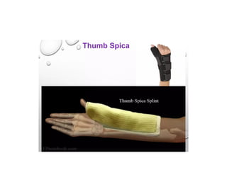 Splinting Methods SPLINTING TECHNIQUES.pptx orthopaedics ppt | PPTX