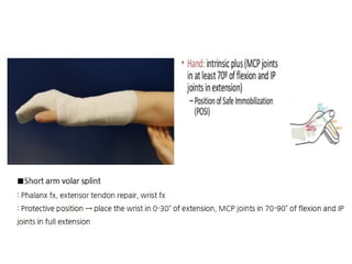 Different Splinting Techniques of Fractures.pptx
