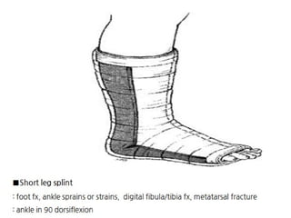 Splinting Skeleton Different Splinting Techniques of Fractures.pptx
