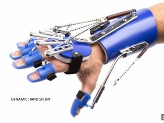 Different Splinting Techniques of Fractures.pptx