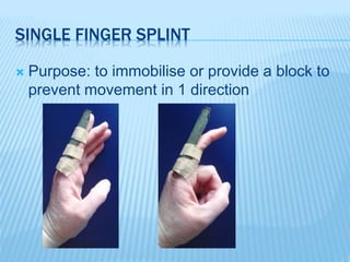 Splinting when you have no therapists | PPTX