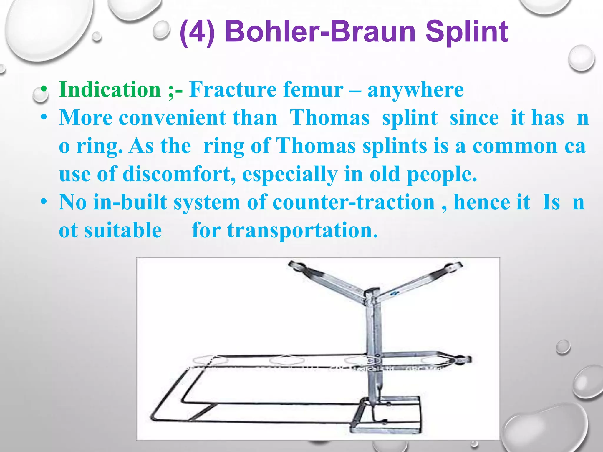 Splint ppt by rupeshkumar | PPTX