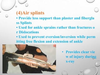 Splint ppt by rupeshkumar | PPTX