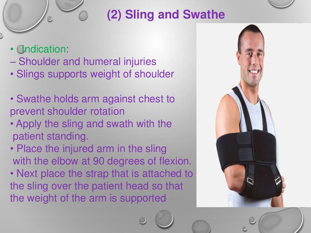 Splint ppt by rupeshkumar