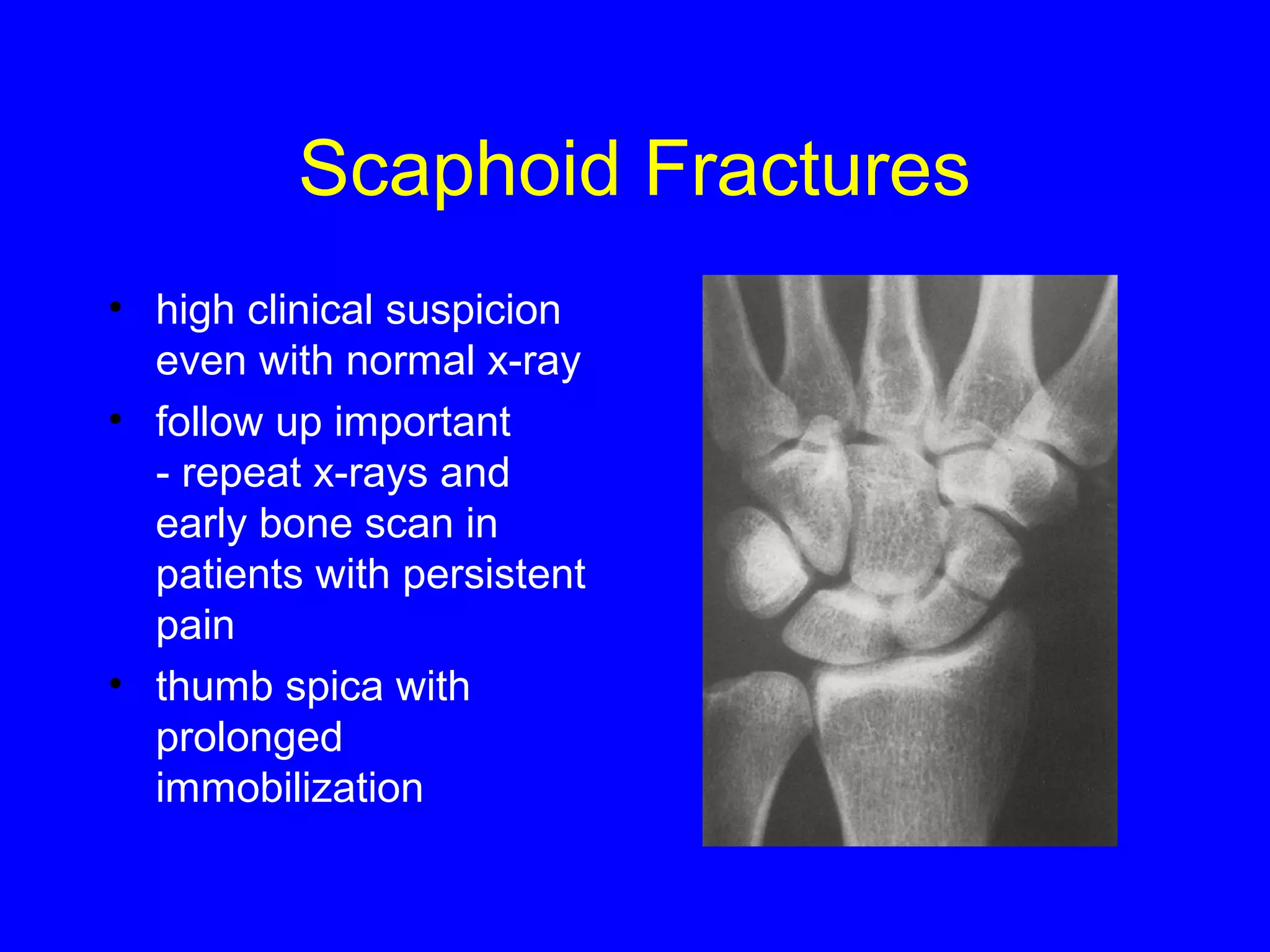 Scaphoid Fractures 
• high clinical suspicion 
even with normal x-ray 
• follow up important 
- repeat x-rays and 
early bone scan in 
patients with persistent 
pain 
• thumb spica with 
prolonged 
immobilization 
 