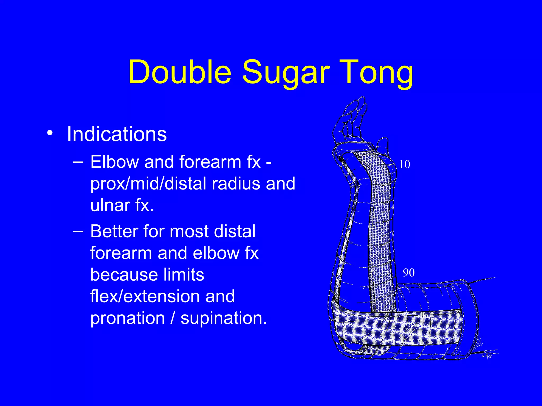 Double Sugar Tong 
• Indications 
– Elbow and forearm fx - 
prox/mid/distal radius and 
ulnar fx. 
– Better for most distal 
forearm and elbow fx 
because limits 
flex/extension and 
pronation / supination. 
10 
90 
 