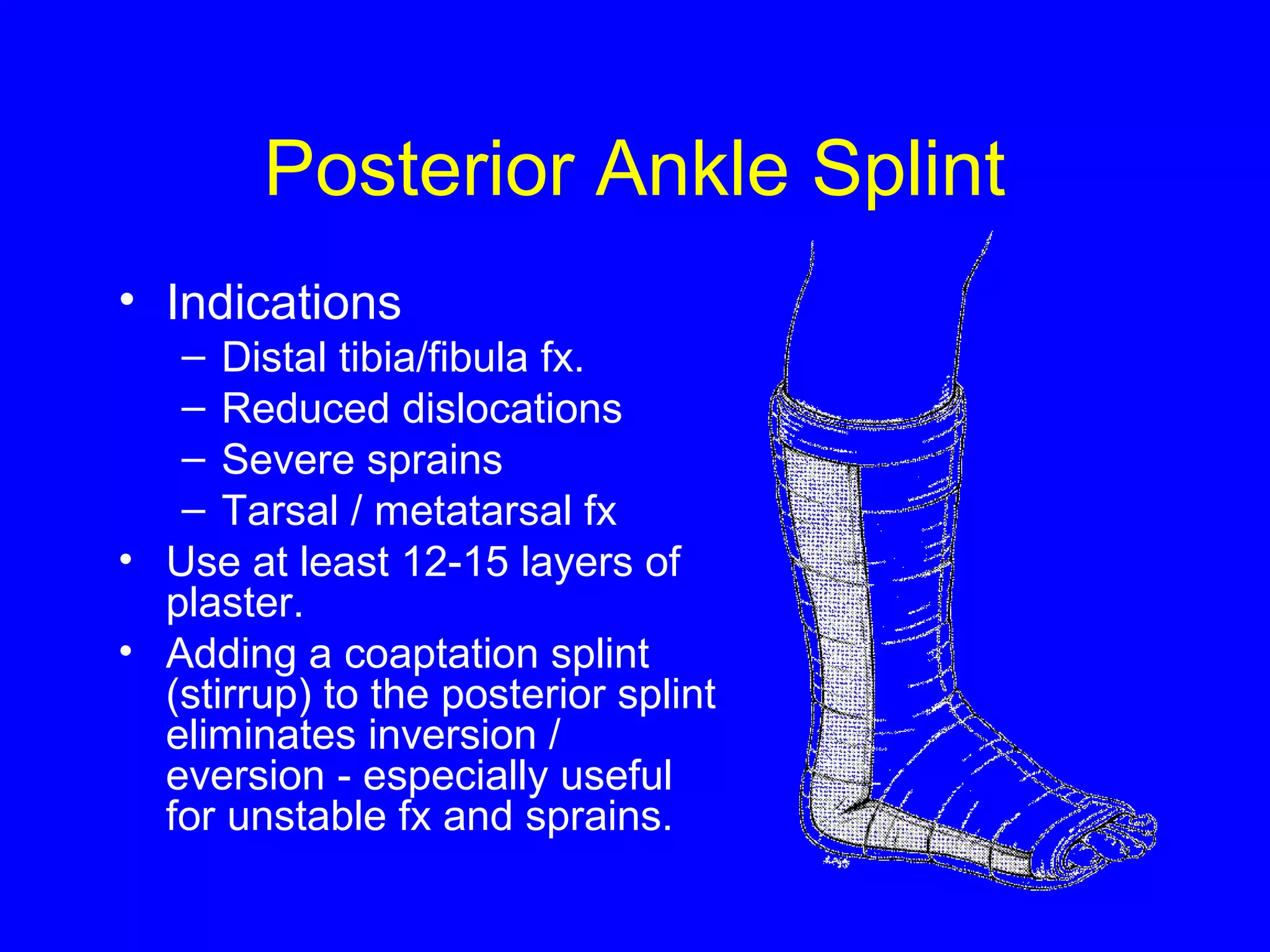 Posterior Ankle Splint 
• Indications 
– Distal tibia/fibula fx. 
– Reduced dislocations 
– Severe sprains 
– Tarsal / metatarsal fx 
• Use at least 12-15 layers of 
plaster. 
• Adding a coaptation splint 
(stirrup) to the posterior splint 
eliminates inversion / 
eversion - especially useful 
for unstable fx and sprains. 
 