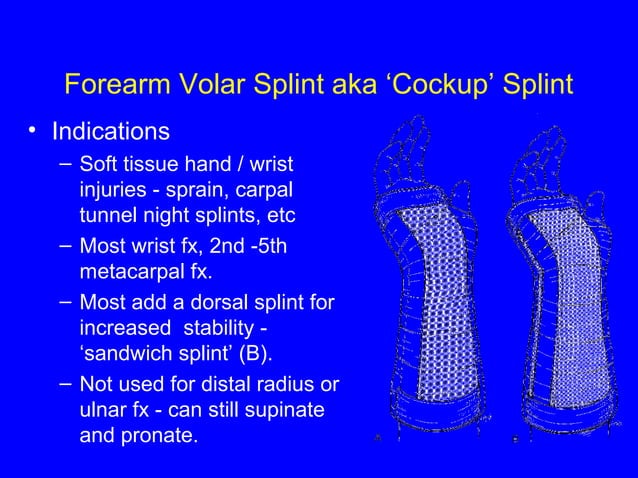 Splints | PPT
