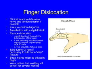 Finger Dislocation 
• Clinical exam to determine 
nerve and tendon function if 
possible 
• X-ray to confirm diagnosis 
• Anesthetize with a digital block 
• Reduce dislocation 
– i. Apply traction in line with the 
distal portion of the finger 
– ii. The deformity should increase 
slightly just prior to joint going 
back in place 
– iii. This should be felt as a click 
• Take further X-rays if 
necessary to rule out a "chip" 
fracture 
• Strap injured finger to adjacent 
finger 
• Warn patient that swelling will 
persist for several months 
 