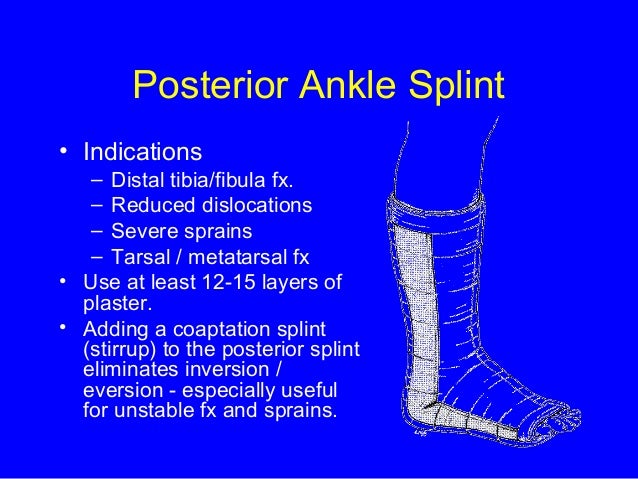 Splints Splints