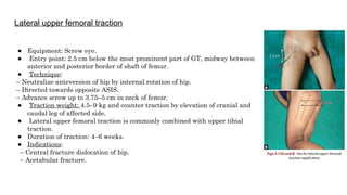 Comprehensive Overview of Splints and Traction Techniques in ...