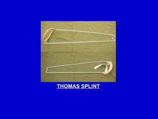 Comprehensive Guide to Splints and Traction Procedures in Orthopaedics ...
