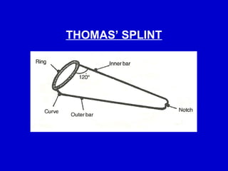 Comprehensive Guide to Splints and Traction Procedures in Orthopaedics ...