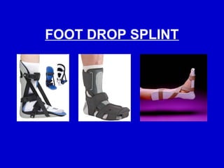Comprehensive Guide to Splints and Traction Procedures in Orthopaedics ...