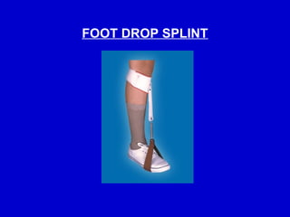 Comprehensive Guide to Splints and Traction Procedures in Orthopaedics ...