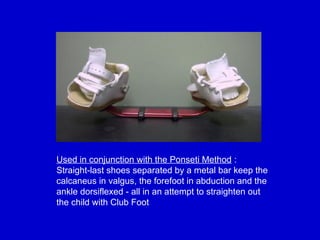Comprehensive Guide to Splints and Traction Procedures in Orthopaedics ...