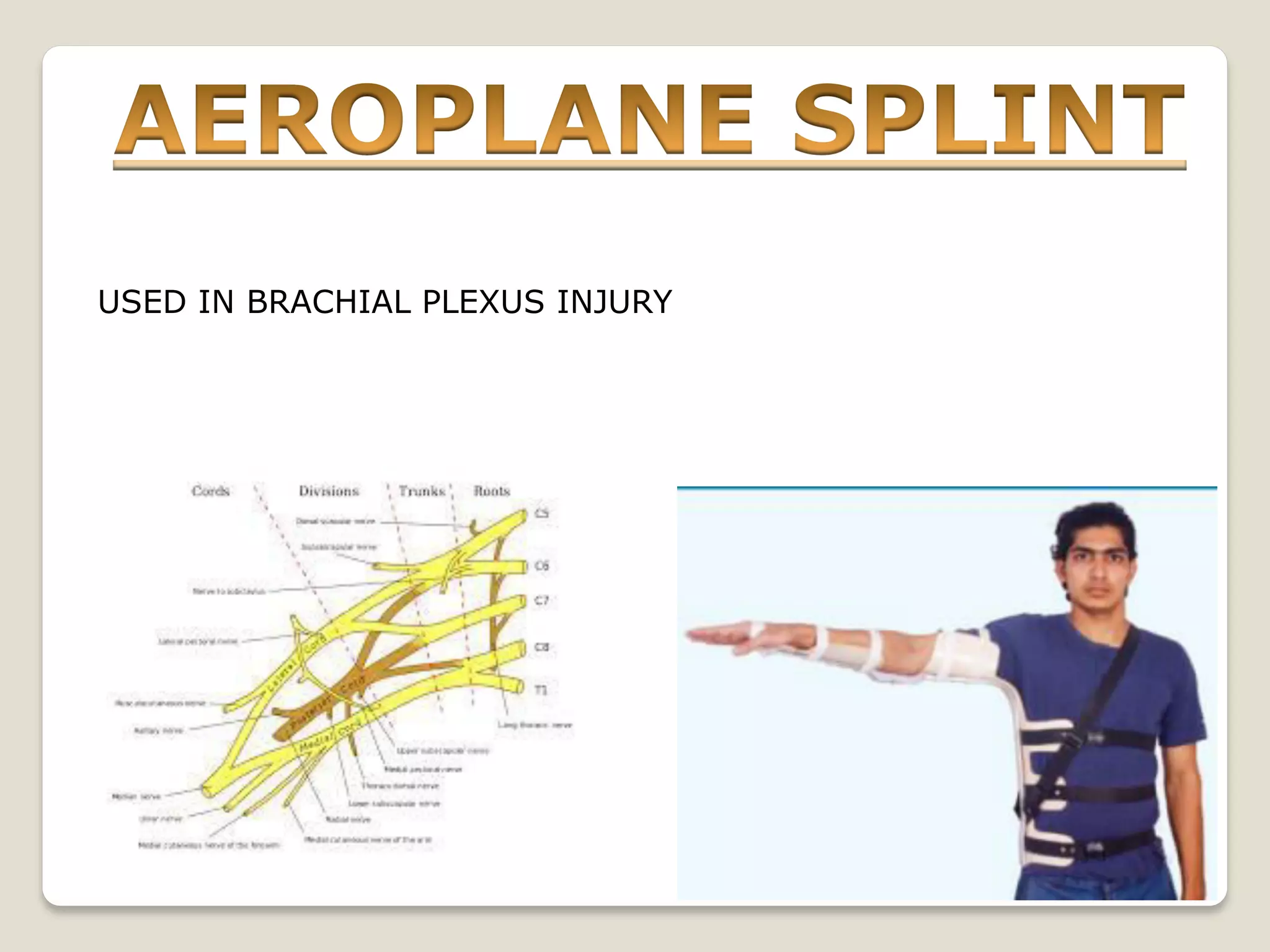 USED IN BRACHIAL PLEXUS INJURY
 