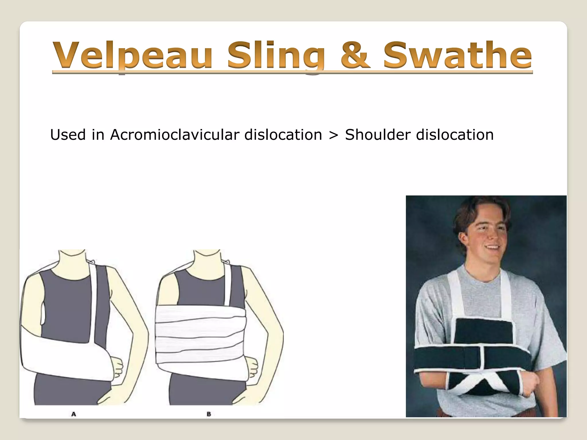 Used in Acromioclavicular dislocation > Shoulder dislocation
 