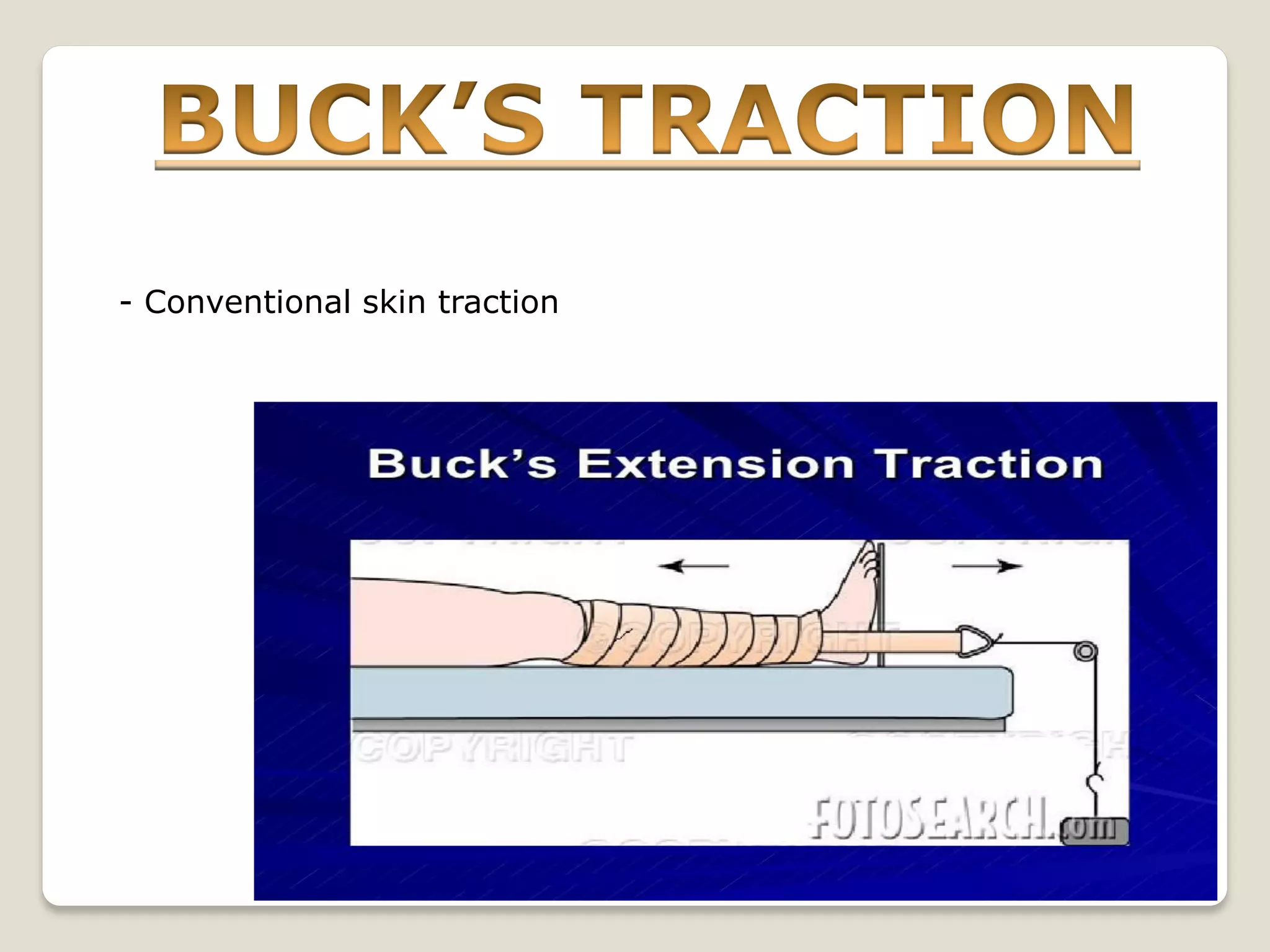 - Conventional skin traction
 